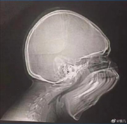 1562231967139741.png image.png